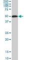 NIMA Related Kinase 10 antibody, H00152110-M01, Novus Biologicals, Western Blot image 