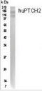 Patched 2 antibody, TA309822, Origene, Western Blot image 