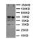 Lamin A/C antibody, PA5-79604, Invitrogen Antibodies, Western Blot image 