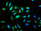 Transmembrane Protein 192 antibody, LS-C376850, Lifespan Biosciences, Immunofluorescence image 