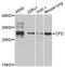 Complement Factor D antibody, MBS9128901, MyBioSource, Western Blot image 