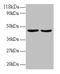 TNF Receptor Superfamily Member 14 antibody, LS-C211647, Lifespan Biosciences, Western Blot image 