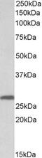 Stratifin antibody, PA5-18462, Invitrogen Antibodies, Western Blot image 