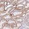 NADH:Ubiquinone Oxidoreductase Core Subunit S2 antibody, NBP2-30413, Novus Biologicals, Immunohistochemistry frozen image 