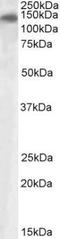 Phospholipase A2 Receptor 1 antibody, GTX88257, GeneTex, Western Blot image 