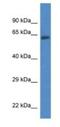 Acyl-CoA Synthetase Family Member 2 antibody, NBP1-74274, Novus Biologicals, Western Blot image 