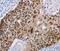 MAGE Family Member A10 antibody, PA5-50444, Invitrogen Antibodies, Immunohistochemistry paraffin image 