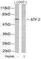 Activating Transcription Factor 2 antibody, LS-B1171, Lifespan Biosciences, Western Blot image 