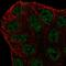 ATP Binding Cassette Subfamily A Member 6 antibody, HPA064878, Atlas Antibodies, Immunofluorescence image 