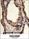 Triosephosphate Isomerase 1 antibody, 61-595, ProSci, Immunohistochemistry paraffin image 