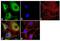 Calcium/calmodulin-dependent protein kinase type 1 antibody, PA1-543, Invitrogen Antibodies, Immunofluorescence image 