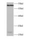 PDZ Domain Containing 1 antibody, FNab06298, FineTest, Western Blot image 