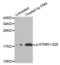 Stathmin 1 antibody, abx000272, Abbexa, Western Blot image 