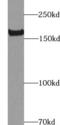 Kinase Insert Domain Receptor antibody, FNab09795, FineTest, Western Blot image 