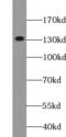 Diacylglycerol Kinase Eta antibody, FNab02359, FineTest, Western Blot image 