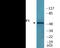 Telomeric Repeat Binding Factor 1 antibody, EKC2340, Boster Biological Technology, Western Blot image 