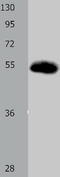 Solute Carrier Family 2 Member 3 antibody, TA321792, Origene, Western Blot image 