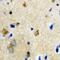 Biotinidase antibody, abx141325, Abbexa, Western Blot image 