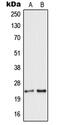 Neuroendocrine protein 7B2 antibody, GTX55171, GeneTex, Western Blot image 