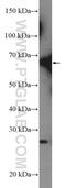 GATA Zinc Finger Domain Containing 2A antibody, 12294-1-AP, Proteintech Group, Western Blot image 