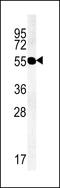 Transmembrane protein 79 antibody, 61-871, ProSci, Western Blot image 