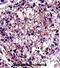 Ras Homolog Family Member C antibody, abx027799, Abbexa, Immunohistochemistry frozen image 