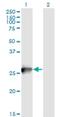 RAB3B, Member RAS Oncogene Family antibody, H00005865-M02, Novus Biologicals, Western Blot image 