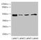 Pyruvate Dehydrogenase Kinase 3 antibody, LS-C676239, Lifespan Biosciences, Western Blot image 