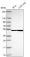 SAP30 Binding Protein antibody, HPA052943, Atlas Antibodies, Western Blot image 