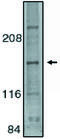 Mitogen-Activated Protein Kinase Kinase Kinase 5 antibody, MBS395847, MyBioSource, Western Blot image 