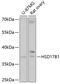 Hydroxysteroid 17-Beta Dehydrogenase 1 antibody, 13-829, ProSci, Western Blot image 