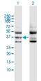 G Protein Subunit Alpha 11 antibody, H00002767-D01P, Novus Biologicals, Western Blot image 