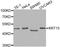 Keratin 15 antibody, A2660, ABclonal Technology, Western Blot image 