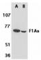 Fem-1 Homolog B antibody, A07467, Boster Biological Technology, Western Blot image 
