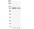 Minichromosome Maintenance Complex Component 2 antibody, R30734, NSJ Bioreagents, Western Blot image 