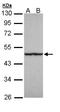 Fumarate Hydratase antibody, LS-B10785, Lifespan Biosciences, Western Blot image 