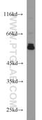 Protein Disulfide Isomerase Family A Member 3 antibody, 15967-1-AP, Proteintech Group, Western Blot image 
