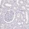 Insulin Like Growth Factor 2 MRNA Binding Protein 1 antibody, PA5-59495, Invitrogen Antibodies, Immunohistochemistry paraffin image 