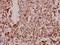Tetraspanin 8 antibody, A06997S129, Boster Biological Technology, Immunohistochemistry paraffin image 