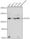SEC24 Homolog D, COPII Coat Complex Component antibody, A06985, Boster Biological Technology, Western Blot image 
