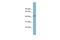 TBC1 Domain Family Member 13 antibody, A15731, Boster Biological Technology, Western Blot image 