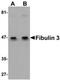 EGF Containing Fibulin Extracellular Matrix Protein 1 antibody, NBP1-77040, Novus Biologicals, Western Blot image 