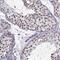 Cyclin K antibody, NBP2-62712, Novus Biologicals, Immunohistochemistry paraffin image 