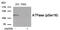 ATPase Na+/K+ Transporting Subunit Alpha 1 antibody, 79-988, ProSci, Western Blot image 