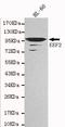Eukaryotic Translation Elongation Factor 2 antibody, LS-B10448, Lifespan Biosciences, Western Blot image 