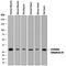 Carbonic Anhydrase 3 antibody, AF2185, R&D Systems, Western Blot image 