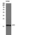 Cystatin SN antibody, STJ92620, St John