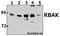 RB Associated KRAB Zinc Finger antibody, A09876-1, Boster Biological Technology, Western Blot image 