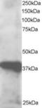 GIPC PDZ Domain Containing Family Member 3 antibody, EB06195, Everest Biotech, Western Blot image 