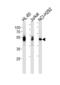 LCK Proto-Oncogene, Src Family Tyrosine Kinase antibody, abx034905, Abbexa, Western Blot image 